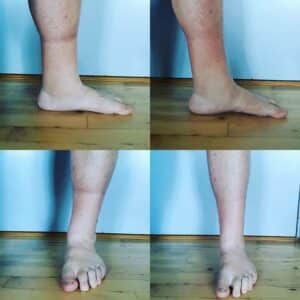 Før og Efter foto ved brug af YourBoots