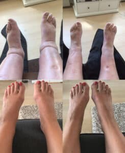 Før og Efter foto ved brug af YourBoots